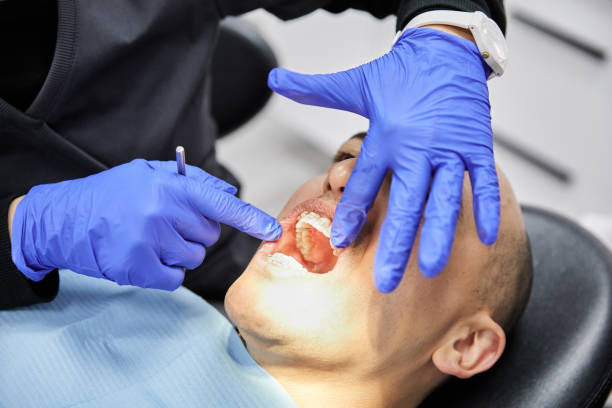 Best Emergency Root Canal Treatment in Summersville, WV
